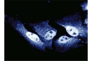 Immunofluorescent staining of HeLa cells.