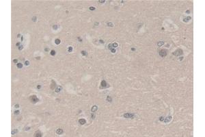 Detection of UBA52 in Human Cerebrum Tissue using Polyclonal Antibody to Ubiquitin A 52 Residue Ribosomal Protein Fusion Product 1 (UBA52)