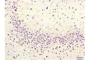Formalin-fixed and paraffin embedded rat brain labeled with Rabbit Anti Cyclooxygenase 2/COX2 Polyclonal Antibody, Unconjugated  at 1:200 followed by conjugation to the secondary antibody and DAB staining
