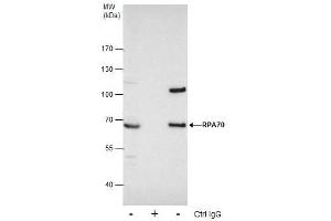 IP Image Immunoprecipitation of RPA70 protein from 293T whole cell extracts using 5 μg of RPA70 antibody [C1C3], Western blot analysis was performed using RPA70 antibody [C1C3], EasyBlot anti-Rabbit IgG  was used as a secondary reagent. (RPA1 anticorps  (C-Term))