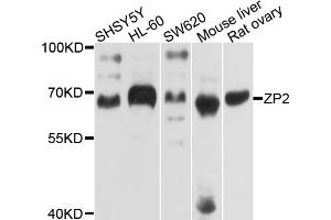 Western blot analysis of extracts of various cell lines, using ZP2 antibody. (ZP2 anticorps)