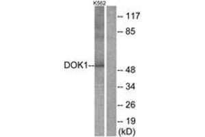 Western blot analysis of extracts from K562 cells, treated with Starvation 24h, using p62 Dok (Ab-398) Antibody. (DOK1 anticorps  (AA 365-414))