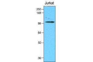 anti-Hexokinase-1/2 (AA 1-917) antibody