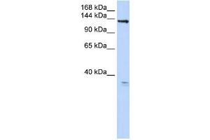 TMEM16C antibody used at 1 ug/ml to detect target protein. (ANO3 anticorps  (C-Term))