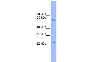 WB Suggested Anti-HSPB8  Antibody Titration: 0. (HSPB8 anticorps  (Middle Region))