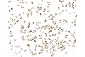 Immunocytochemistry (ICC) image for anti-Thrombomodulin (THBD) (AA 17-515) antibody (ABIN7795643)