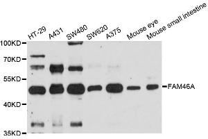 Western blot analysis of extracts of various cell lines, using FAM46A antibody. (FAM46A anticorps)