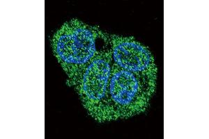 Immunofluorescence (IF) image for anti-Surfactant Protein C (SFTPC) antibody (ABIN2997467) (Surfactant Protein C anticorps)