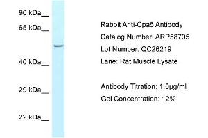 Western Blotting (WB) image for anti-Carboxypeptidase A5 (CPA5) (N-Term) antibody (ABIN2787796)