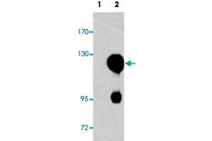 Western blot analysis of ROR2 (arrow) using ROR2 polyclonal antibody . (ROR2 anticorps  (N-Term))