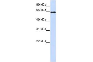PAPSS2 antibody used at 1 ug/ml to detect target protein.