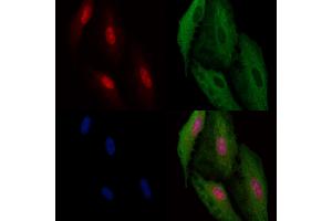 ABIN6260726 and ABIN6266946 staining  cells by IF/ICC.