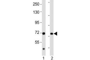 Western blot testing of AACS antibody at 1:2000 dilution. (AACS anticorps  (AA 539-573))