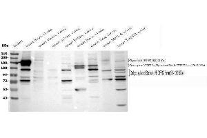 Western blot analysis of VEGF Receptor 2 using anti-VEGF Receptor 2 antibody (ABIN5693262). (VEGFR2/CD309 anticorps  (AA 20-244))