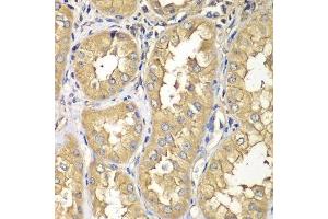 Immunohistochemistry of paraffin-embedded human kidney using RAB5C antibody.