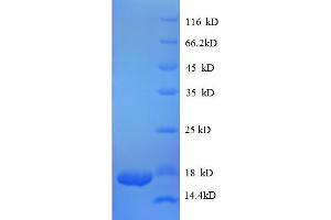 SDS-PAGE (SDS) image for Transforming Growth Factor, beta 1 (TGFB1) (AA 281-390), (partial) protein (His tag) (ABIN5712518)