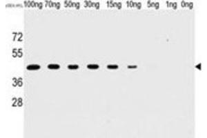 Western Blotting (WB) image for anti-Tyr/ser Protein Phosphatase antibody (ABIN2995280) (Tyr/ser Protein Phosphatase anticorps)