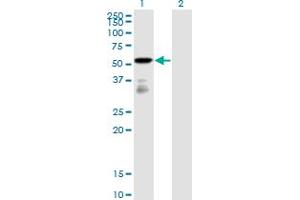 Western Blot analysis of FGFR1OP expression in transfected 293T cell line by FGFR1OP monoclonal antibody (M01), clone 2B1. (FGFR1OP anticorps  (AA 1-379))