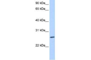 WB Suggested Anti-ZNF664 Antibody Titration:  0. (ZNF664 anticorps  (N-Term))