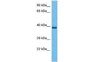 Western Blotting (WB) image for anti-Olfactory Receptor, Family 5, Subfamily H, Member 2 (OR5H2) (C-Term) antibody (ABIN2791755) (OR5H2 anticorps  (C-Term))
