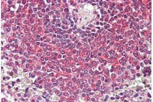 Anti-NF-KappaB p105 antibody IHC staining of human spleen.