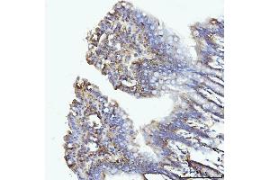 IHC analysis of GLUL using anti-GLUL antibody (ABIN7602403). (GLUL anticorps  (AA 74-373))