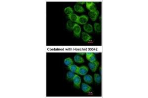 ICC/IF Image Immunofluorescence analysis of methanol-fixed A431, using PD-ECGF, antibody at 1:500 dilution.