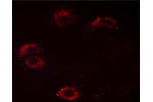 ABIN6267532 staining HUVEC cells by ICC/IF. (Crk anticorps  (pTyr221))