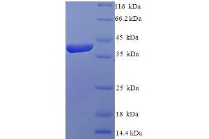 SDS-PAGE (SDS) image for IZUMO Family Member 4 (IZUMO4) (AA 16-214), (Isoform 2) protein (His-SUMO Tag) (ABIN5711353)