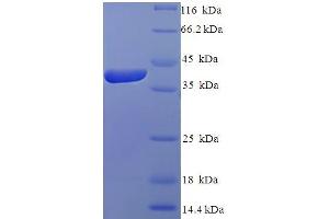 SDS-PAGE (SDS) image for IZUMO Family Member 4 (IZUMO4) (AA 16-214), (Isoform 2) protein (His-SUMO Tag) (ABIN5711353) (IZUMO4 Protein (AA 16-214, Isoform 2) (His-SUMO Tag))