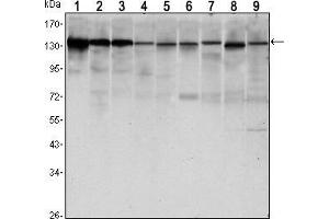 Western blot analysis using CDH1 mouse mAb against LNCAP (1),A431 (2), DU145 (3), PC-3 (4), MCF-7 (5), PC-12 (6), NIH/3T3 (7), C6 (8) and COS7 (9) cell lysate.