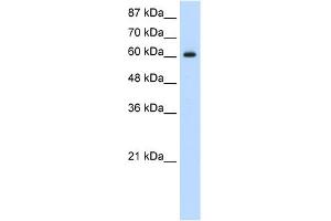 WB Suggested Anti-HIF3A Antibody Titration:  1. (HIF3A anticorps  (C-Term))