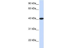 WB Suggested Anti-GTF2B Antibody Titration:  0. (GTF2B anticorps  (N-Term))
