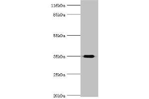 Western blot All lanes: DIMT1 antibody at 2 μg/mL + Mouse thymus tissue Secondary Goat polyclonal to rabbit IgG at 1/10000 dilution Predicted band size: 35 kDa Observed band size: 35 kDa (DIMT1 anticorps  (AA 1-313))
