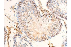 ABIN6267283 at 1/100 staining mouse testicular tissue sections by IHC-P.