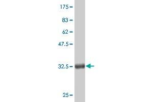 Western Blot detection against Immunogen (36. (CTNNB1 anticorps  (AA 682-781))