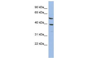 WB Suggested Anti-OLAH  Antibody Titration: 0. (OLAH anticorps  (N-Term))