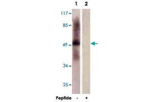 Western blot analysis of extracts from HepG2 cells, using TPH1 polyclonal antibody . (Tryptophan Hydroxylase 1 anticorps  (AA 25-75))
