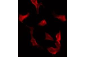 ABIN6275618 staining Hela by IF/ICC. (SYT16 anticorps  (Internal Region))