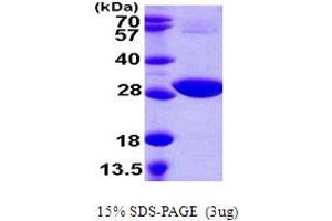 CysH (AA 1-244) protein (His tag)