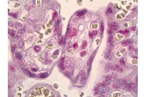 Anti-MSK1 antibody IHC of human placenta.