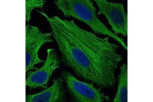 Immunofluorescent staining of Hela cells with SMCP monoclonal antibody, clone 5C10D8  at 1:200-1:1000 dilution. (SMCP anticorps)