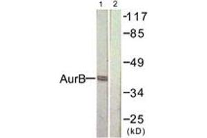 Western blot analysis of extracts from COS7 cells, treated with Nocodazole 1ug/ml 16h, using AurB (Ab-232) Antibody. (Aurora Kinase B anticorps  (AA 198-247))