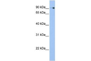 WB Suggested Anti-NOC3L Antibody Titration:  0. (NOC3L anticorps  (N-Term))