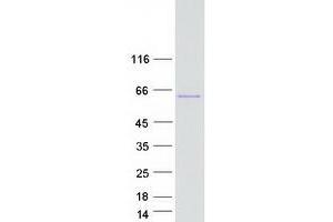 Validation with Western Blot