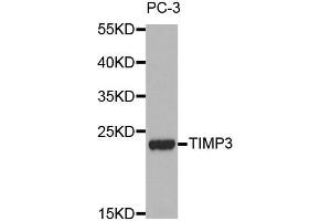 Western blot analysis of extracts of PC-3 cell lines, using TIMP3 antibody. (TIMP3 anticorps  (AA 24-211))
