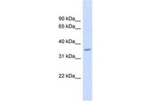 Image no. 1 for anti-Family with Sequence Similarity 26, Member F (FAM26F) (AA 143-192) antibody (ABIN6742019) (FAM26F anticorps  (AA 143-192))