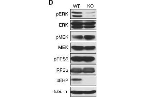 Depletion of 4EHP expression affects cell proliferation, survival, and ERK1/2 phosphorylation. (EIF4E2 anticorps)