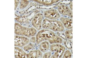 Immunohistochemistry of paraffin-embedded rat kidney using VCP Rabbit pAb (ABIN6128632, ABIN6150072, ABIN6150073 and ABIN6217335) at dilution of 1:100 (40x lens).