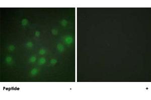 Immunofluorescence analysis of HUVEC cells, using HKR1 polyclonal antibody . (HKR1 anticorps)